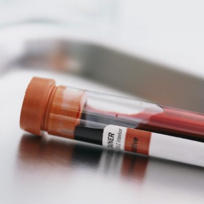 NY Top Court Hears Case Involving Blood Sample Lost In Storm