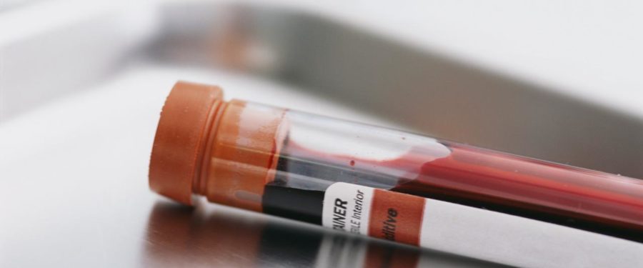 NY Top Court Hears Case Involving Blood Sample Lost In Storm