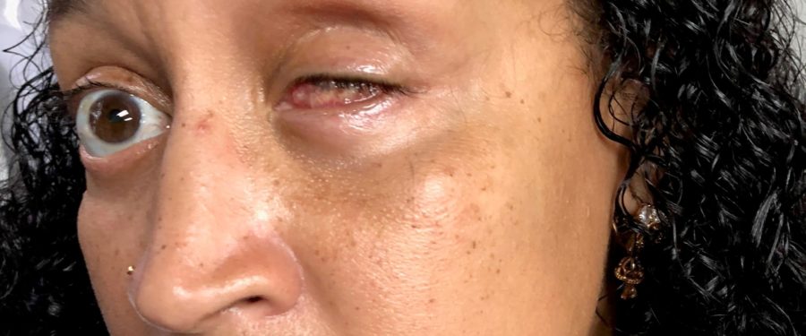 Calls On Bronx DA To Dismiss Charges Against Johanna Pagan-Alomar Who Lost Her Eye During Violent Arrest