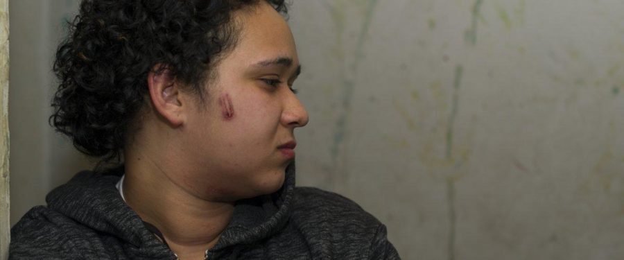 Bronx Man Hit With Stun Gun By Cops To Stop Him Beating His Wife May Go Blind In One Eye