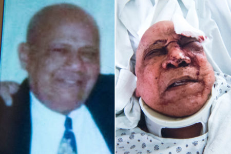 Mugger Violently Robs Elderly Man In Bronx