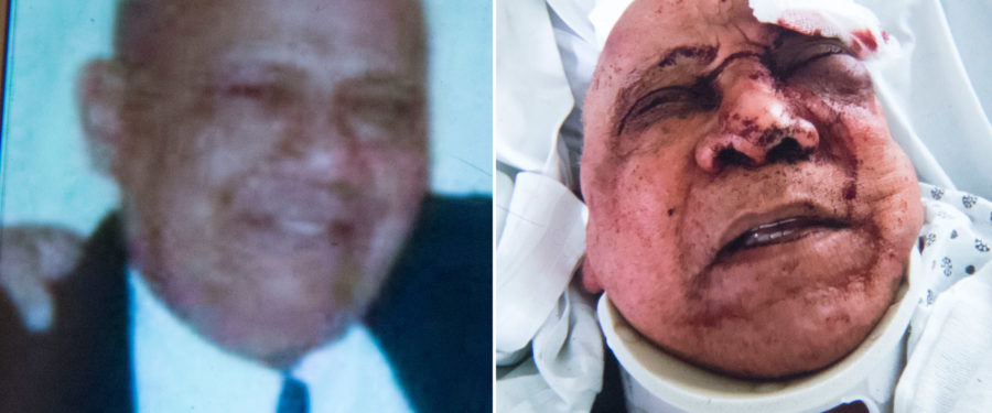 Mugger Violently Robs Elderly Man In Bronx