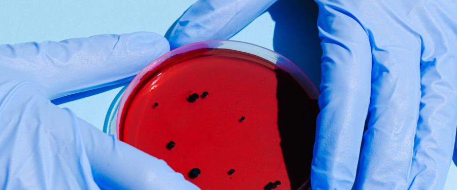 Local Manufacturers Scaling Up Production Of Critical Testing Supplies