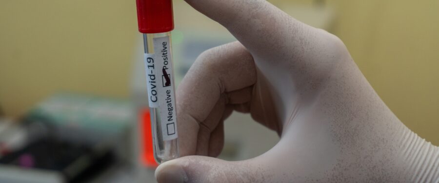 City Builds Out $900 Million Stockpile Ahead Of 2<sup>nd</sup> CoViD-19 Wave